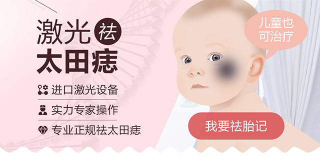 兰州激光祛太田痣