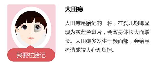太田痣
