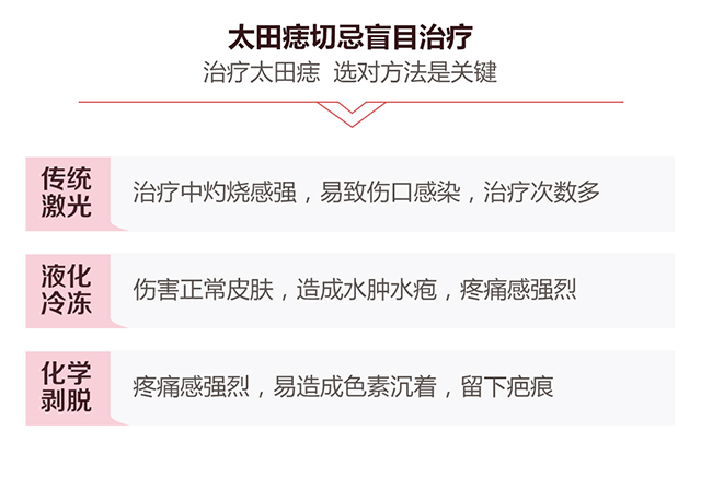 太田痣切勿盲目治疗