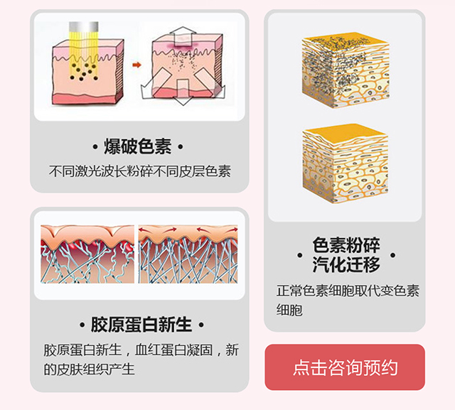 点击咨询预约