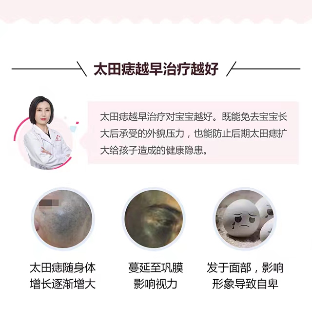 太田痣越早治越好