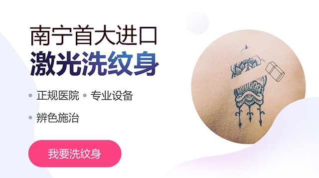 兰州激光洗纹身