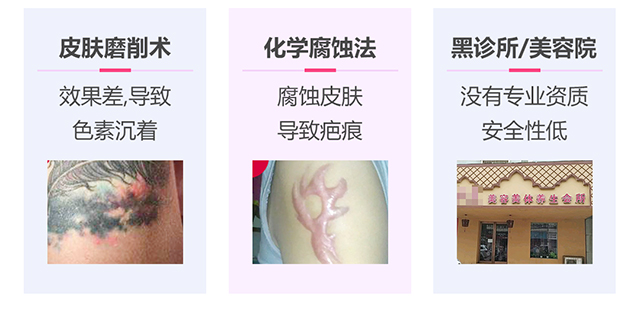 洗纹身错误方法