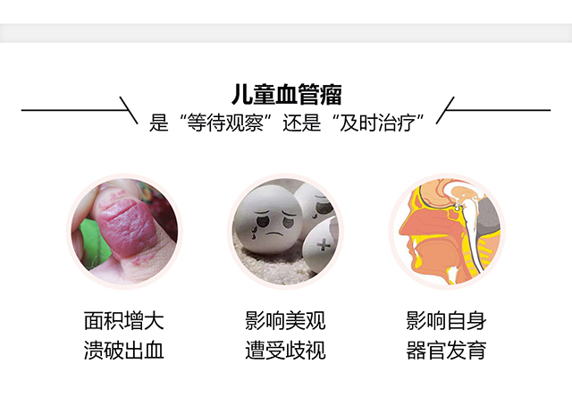 兰州儿童血管瘤